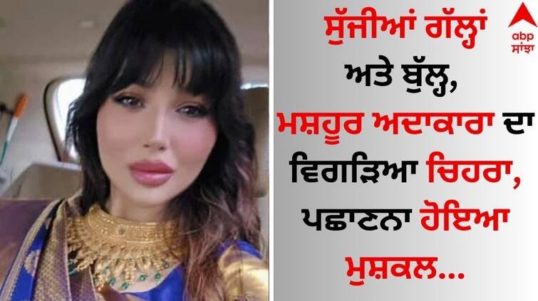 Ayesha Takia Looks Unrecognizable In Pics, users said `Why You Destroyed Your Face?` Pics Viral: ਸੁੱਜੀਆਂ ਗੱਲ੍ਹਾਂ ਅਤੇ ਬੁੱਲ੍ਹ, ਮਸ਼ਹੂਰ ਅਦਾਕਾਰਾ ਦਾ ਵਿਗੜਿਆ ਚਿਹਰਾ, ਪਛਾਣਨਾ ਹੋਇਆ ਮੁਸ਼ਕਲ 