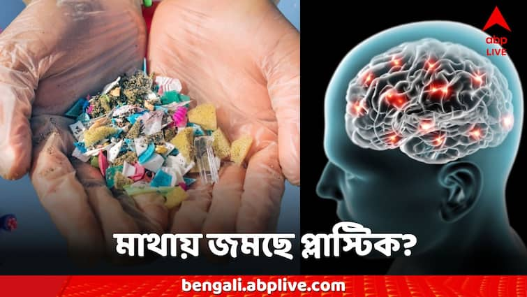 Science News Microplastics Invade Human Brains, Researchers Call For Global Emergency Science News: অজান্তেই মস্তিষ্কে জমছে প্লাস্টিক, ঘনাচ্ছে বড় রোগ, 'Emergency' ঘোষণার আর্জি গবেষকদের