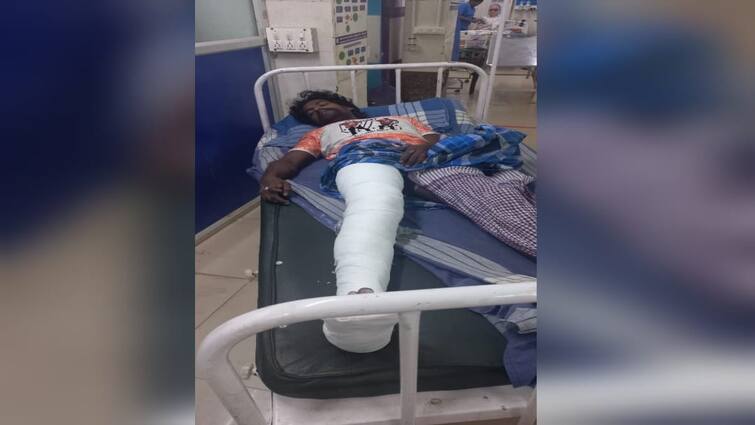 Tenkasi news Famous rowdy breaks leg  while trying to escape police arrested - TNN தப்பியோட முயன்ற பிரபல ரவுடிக்கு கால்முறிவு..! சுற்றி வளைத்து கைது செய்த போலீசார்!