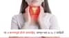 थायरॉईडचा त्रास होण्यामागं आहेत ही 4 कारणं, हा आजार बरा होऊ शकतो का? वाचा A टू Z माहिती