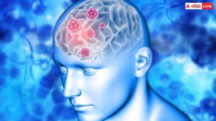 આ માઇક્રોપ્લાસ્ટિક્સનું કદ 5 મિલીમીટર અથવા 1 નેનોમીટરથી ઓછું હોઈ શકે છે. આ પ્લાસ્ટિક ખાવા પીવા દ્વારા શરીરની અંદર એકઠું થાય છે. છેલ્લા 8 વર્ષમાં મગજમાં વધુ પડતું પ્લાસ્ટિક જમા થયું છે.