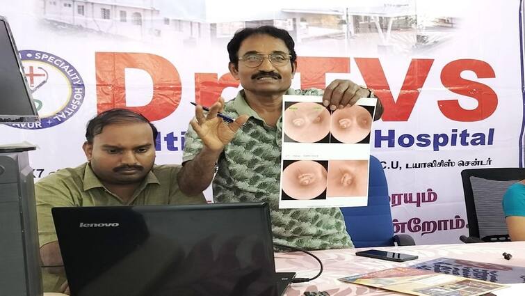 Child in Danger after Swallowing Groundnut: Thanjavur Dr TVS Hospital Doctors Rescue நிலக்கடலையை விழுங்கிய குழந்தை: என்டரஸ்கோபிக் மூலம் காப்பாற்றிய மருத்துவர்கள்! நடந்தது என்ன?