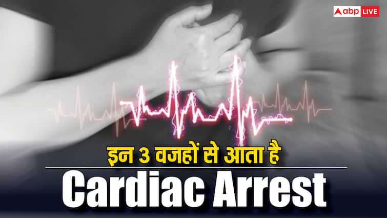 There are three reasons responsible for sudden cardiac arrest, guess what