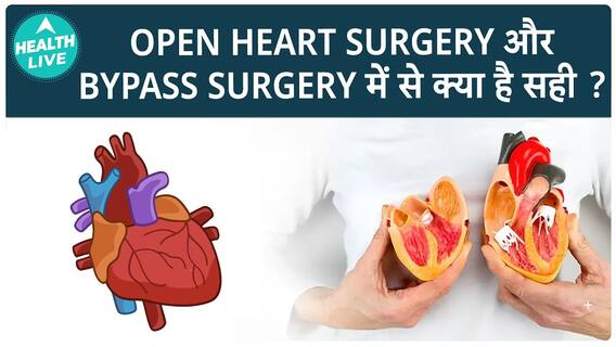 Open Heart Surgery vs. Bypass Surgery: Which One Is The Better Choice | Health Live