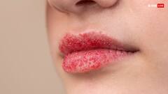 Lip Scrub: इन 2 चीजों का इस्तेमाल कर तैयार करें लिप स्क्रब, काले होंठो से मिलेगा छुटकारा