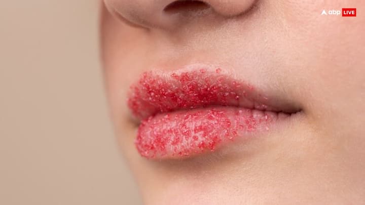 Lip Scrub: अगर आप भी काले होंठ की वजह से परेशान रहते हैं, तो अब आपको परेशान होने की जरूरत नहीं है. क्योंकि आज हम आपको ऐसे स्क्रब के बारे में बताएंगे, जिसे आप घर पर कम समय में तैयार कर सकते हैं.