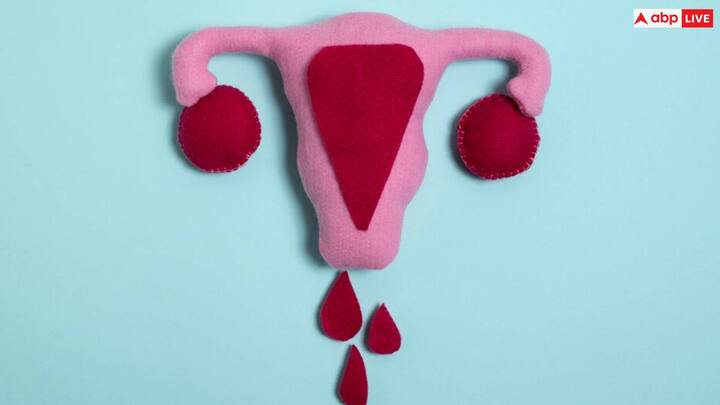 पीसीओडी में वेट लॉस करना काफी ज्यादा मुश्किल होता है. एक्सपर्ट की मानें तो हेल्दी डाइट और लाइफस्टाइल के जरिए वेट लॉस किया जा सकता है. लेकिन कुछ चीजों का खास ध्यान रखना चाहिए.