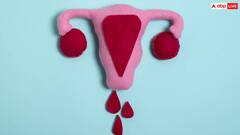 Health Tips: PCOD से बढ़ गया है काफी ज्यादा वजन तो वेट लॉस करने का यह तरीका अपनाएं