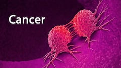 Cancer Symptom: ਸਰੀਰ 'ਚ 7 ਤਬਦੀਲੀਆਂ ਨਾ ਕਰੋ ਨਜ਼ਰਅੰਦਾਜ! ਕੈਂਸਰ ਦੇ ਹੋ ਸਕਦੇ ਸੰਕੇਤ