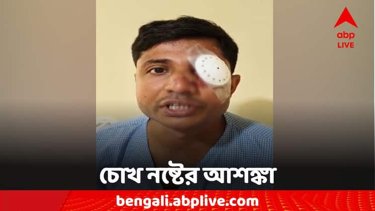 Nabanna Abhijan traffic sergeant's eyes are feared to be damaged Nabanna Abhijan: নবান্ন অভিযানে ধুন্ধুমারে চোখ নষ্টের আশঙ্কা পুলিশের, চিকিৎসার জন্য নিয়ে যাওয়া হচ্ছে ভিন রাজ্যে