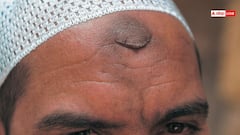 मुसलमानों के माथे पर क्यों होता है काला निशान?