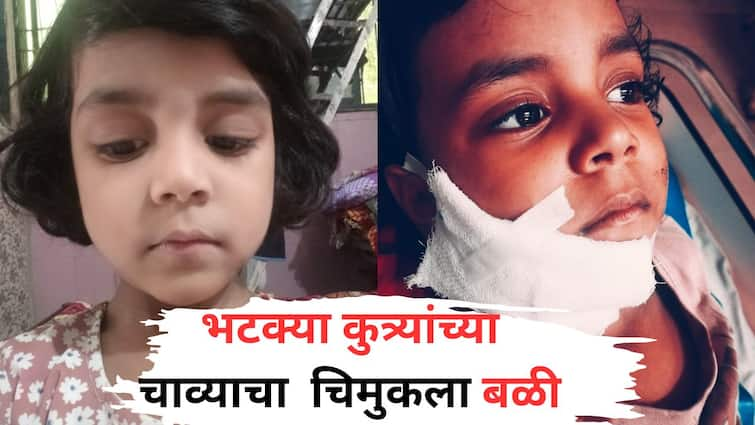 Bhiwandi Crime News 4 Year Old Girl Child Dies After Stray Dog Attack New Azad Nagar MLA Demands Action Know All Details Bhiwandi Crime : पिसाळलेल्या भटक्या कुत्र्यांनी चिमुकलीचं आयुष्य संपवलं; हल्ल्यात जखमी चिमुरडीचा दुर्दैवी अंत