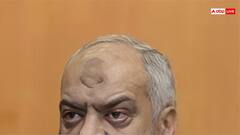 मुसलमानों के माथे पर क्यों होता है काला निशान?