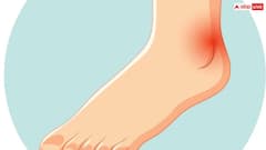Heart Attack: क्या पैर में भी हो सकता है हार्ट अटैक के शुरुआती दर्द? जान लीजिए जवाब