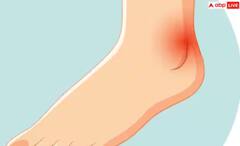 Heart Attack: ਕੀ ਪੈਰਾਂ 'ਚ ਵੀ ਹੋ ਸਕਦਾ ਹਾਰਟ ਅਟੈਕ ਦਾ ਸ਼ੁਰੂਆਤੀ ਦਰਦ? ਇੱਥੇ ਜਾਣੋ ਜਵਾਬ