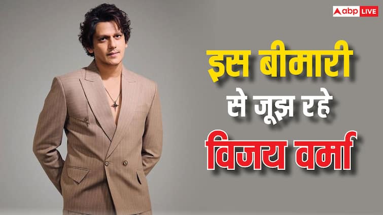 vijay varma hide about his skin disease vitligo said I have covered it up for movies because it distracts विजय वर्मा ने सबसे छुपा रखी थी अपनी ये बीमारी, कहा- 'मुझे फिक्र थी कि कही रुकावट ना बन जाए...'