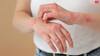 Psoriasis: पुरुषों में सोरायसिस होने की संभावना महिलाओं की तुलना में दोगुनी होती है, जानें इसके लक्षण
