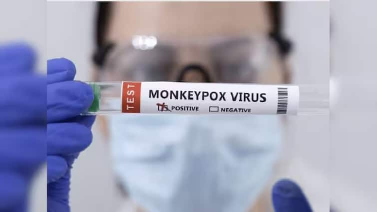 Mpox alert India prepares on a large scale to fight monkeypox report will come in 40 minutes with new test kit Mpox alert- ਭਾਰਤ ਵੱਲੋਂ ਮੰਕੀਪੌਕਸ ਦੇ ਟਾਕਰੇ ਲਈ ਵੱਡੇ ਪੱਧਰ 'ਤੇ ਤਿਆਰੀਆਂ, ਨਵੀਂ ਜਾਂਚ ਕਿੱਟ ਨਾਲ 40 ਮਿੰਟਾਂ ਵਿਚ ਆਵੇਗੀ ਰਿਪੋਰਟ