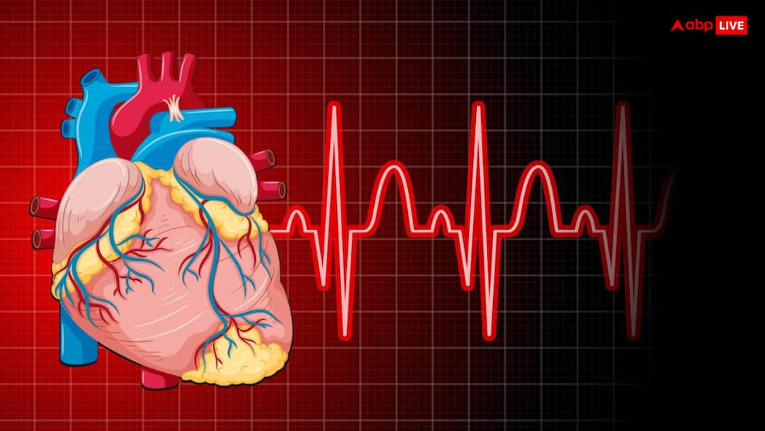 What Is Cardiac Arrest Find Out Why Its More Dangerous Than a Heart Attack कार्डियक अरेस्ट क्या है? कैसे यह हार्ट अटैक से भी ज्यादा खतरनाक है, जानें एक्सपर्ट से