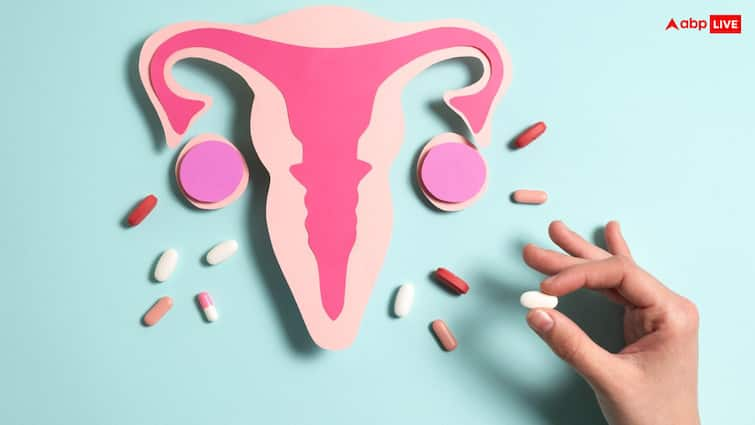 Can PCOS Ever Be Cured? Know What Experts Say