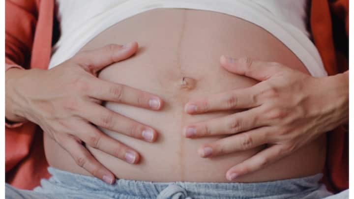 Take a balanced diet: Your diet also affects the health of your skin. During pregnancy, take a diet rich in vitamin C, vitamin E, zinc, and protein. These nutrients strengthen your skin and protect it from stretching.