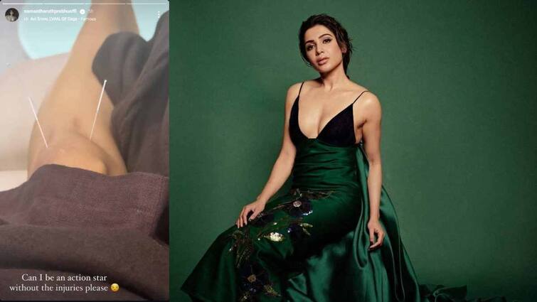 Actress Samantha Ruth Prabhu gets injured during action sequence shooting Samantha: సమంతకు షూటింగులో గాయాలు... దెబ్బలు తగలకుండా యాక్షన్ స్టార్ అవ్వొచ్చా?