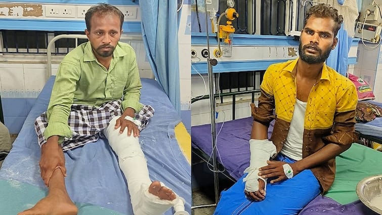 The chain thieves broke their arms and legs by hitting the wall of the bridge while being chased away by the police போலீசார் விரட்டியதில் பாலத்தின் சுவற்றில் மோதி கை, கால்களை முறித்துக் கொண்ட செயின் திருடர்கள்