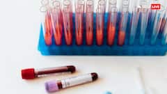 एक नहीं इतने रंग का होता है खून, जानें जानवरों से कितना है अलग