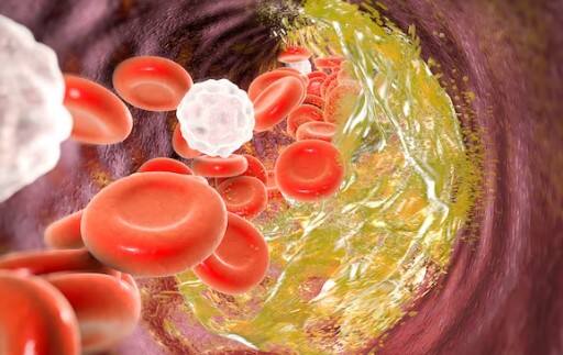 Include this item in your Diet to keep Bad cholesterol control Cholesterol :  બેડ કોલેસ્ટ્રોલને નિયંત્રણમાં રાખવા માટે ડાયેટમાં સામેલ કરો આ વસ્તુ 