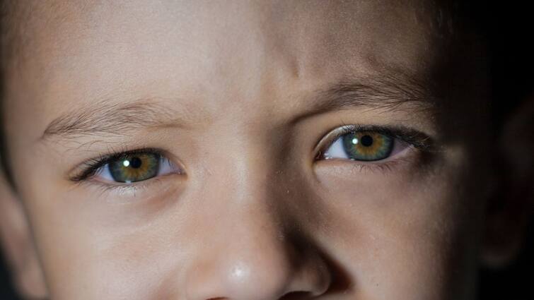 Say Goodbye To Dark Circles Try These 5 Expert-Approved Home Remedies To Tackle Them Say Goodbye To Dark Circles:கருவளையம் பிரச்சனைக்கு தீர்வு - ஆயுர்வேதம் மருத்துவத்தின் பரிந்துரைகள்!