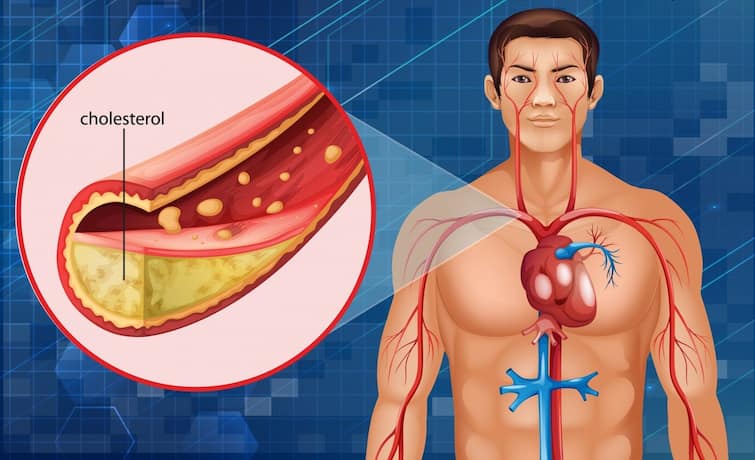 Bad Cholesterol Levels Rising Include this food regularly in the diet, there will be benefits Heart Care Tips: બેડ કોલેસ્ટ્રોલનું સ્તર વધી રહ્યું છે? આ ફૂડને ડાયટમાં અચૂક કરો સામેલ, થશે ફાયદા