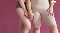 Health Tips: 9થી 5ની નોકરી કરતા લોકો સાવધાન! બની શકો છો 'ડેડ બટ્ટ સિન્ડ્રોમ'નો શિકાર