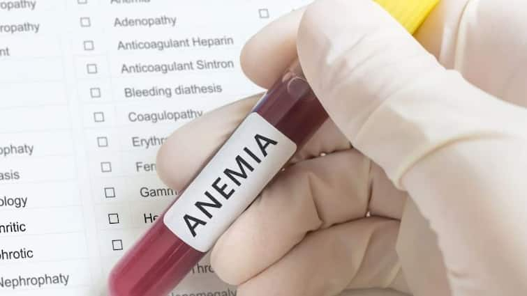 anemia-in-indian-women-know-its-symptoms-and-prevention Anemia In Women's: ਭਾਰਤ 'ਚ 40 ਫੀਸਦੀ ਔਰਤਾਂ ਖੂਨ ਦੀ ਕਮੀ ਨਾਲ ਹਨ ਪੀੜਤ, ਜਾਣੋ ਕੀ ਹੈ ਕਾਰਨ