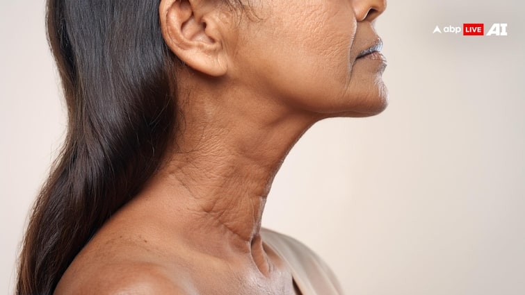 know why neck is more affected by wrinkles and fine lines instead of face चेहरे के मुकाबले गर्दन से क्यों जल्दी झलकता है बुढ़ापा, स्किन पर क्यों पड़ने लगती हैं झुर्रियां?