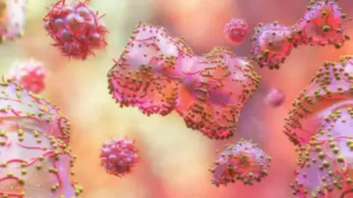 ਅਜਿਹੀ ਸਥਿਤੀ ਵਿੱਚ, ਆਓ ਅਸੀਂ ਤੁਹਾਨੂੰ ਦੱਸਦੇ ਹਾਂ ਕਿ ਮੰਕੀਪੌਕਸ ਕੀ ਹੈ, ਇਸਦੇ ਲੱਛਣ ਕੀ ਹਨ (monkey pox symptoms) ਅਤੇ ਤੁਸੀਂ ਇਸ ਨੂੰ ਕਿਵੇਂ ਰੋਕ ਸਕਦੇ ਹੋ (monkey pox treatment), ਤਾਂ ਜੋ ਤੁਸੀਂ ਕਿਸੇ ਵੀ ਸਥਿਤੀ ਵਿੱਚ ਪੈਨਿਕ ਨਾ ਹੋਵੋ ਅਤੇ ਆਸਾਨੀ ਨਾਲ ਇਸ ਬਿਮਾਰੀ ਤੋਂ ਛੁਟਕਾਰਾ ਪਾ ਸਕੋ।