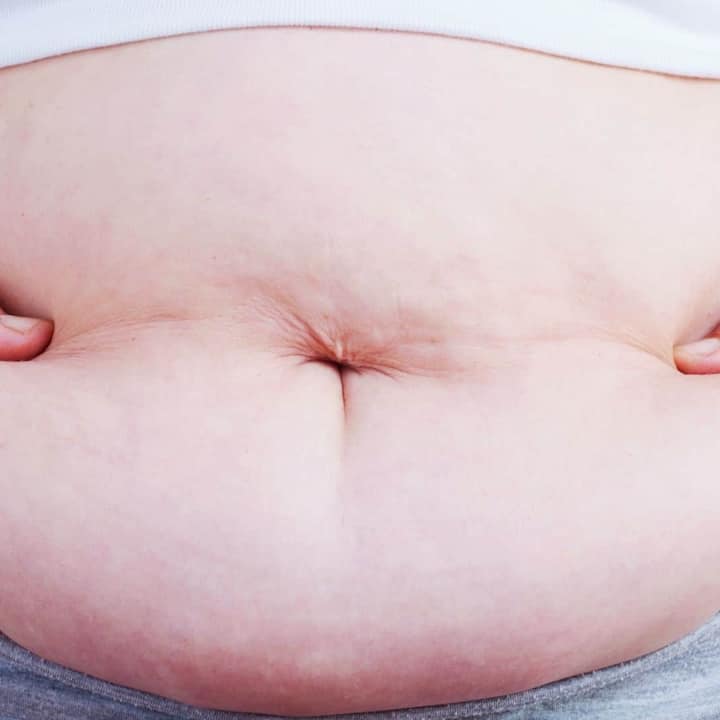 Today in this article we are telling you about the serious effects of obesity on sex life.