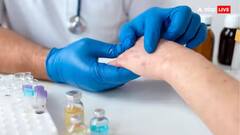 Monkeypox: કઇ રીતે જાણશો તમે પણ મન્કીપૉક્સની ઝપેટમાં આવ્યા છો ? આ છે ઓળખવાની રીત