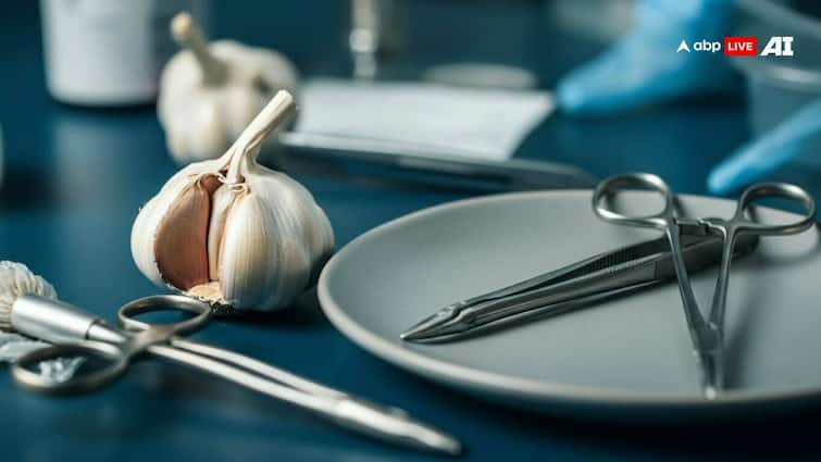 Why You Shouldn’t Eat Garlic Before Surgery? Know the Reason