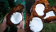 Coconut Benefits: தேங்காயில் இவ்வளவு மருத்துவ குணங்கள் நிறைந்திருக்கா? தெரிஞ்சிக்கோங்க!