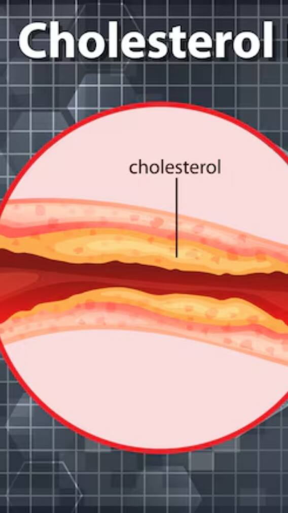 कोलेस्ट्रॉल को जमा नहीं होने देगी ये चीज