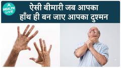 What Is Alien Hand Syndrome? Rare Disorder Causes Uncontrollable Hand Movements | Health Live