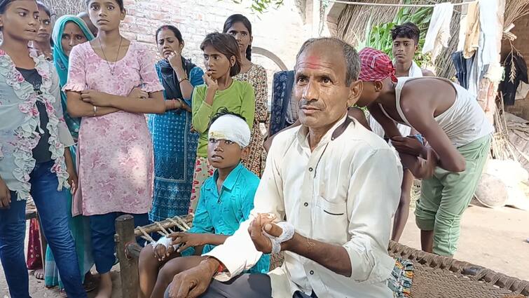 कानपुर: भेड़िये के आतंक से खौफजदा हैं ग्रामीण, दो दिन में चार लोगों पर किया हमला