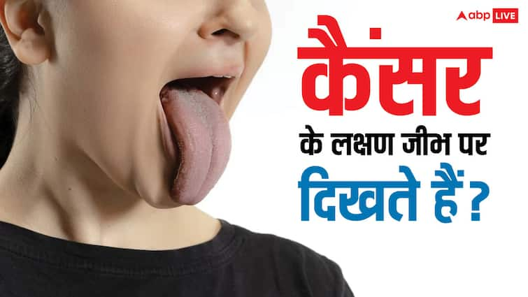 Cancer symptoms can also be seen under the tongue, know how to detect it