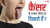 Cancer Symptoms: जीभ के नीचे भी दिख सकते हैं कैंसर के लक्षण, जानें कैसे लगाएं इसका पता