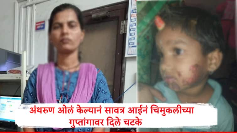 Kolhapur Crime Girl wet the bed in her sleep step mother slapped her private parts Maharashtra Crime Kolhapur Crime: मुलीने झोपेत बिछाना ओला केला, सावत्र आईने गुप्तांगावर दिले चटके, कोल्हापूरमधील धक्कादायक घटना