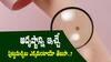 Lucky Moles: అదృష్టాన్ని తీసుకొచ్చే పుట్టుమచ్చలు, శరీరంపై ఎక్కడ ఉంటే ఏం ప్రయోజనమో తెలుసా?