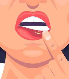 ਸਾਵਧਾਨ! ਜੀਭ ਦੇ ਹੇਠਾਂ ਵੀ ਨਜ਼ਰ ਆ ਸਕਦੇ ਕੈਂਸਰ ਦੇ ਲੱਛਣ