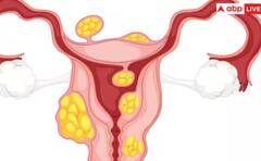ਬੱਚੇਦਾਨੀ 'ਚ ਅਕਸਰ ਹੁੰਦੀਆਂ ਆਹ ਖਤਰਨਾਕ ਬਿਮਾਰੀਆਂ, ਨਜ਼ਰਅੰਦਾਜ਼ ਕਰਨਾ ਪੈ ਸਕਦਾ ਮਹਿੰਗਾ