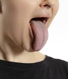 ਸਾਵਧਾਨ! ਜੀਭ ਦੇ ਹੇਠਾਂ ਵੀ ਨਜ਼ਰ ਆ ਸਕਦੇ ਕੈਂਸਰ ਦੇ ਲੱਛਣ