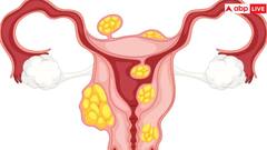 बच्चेदानी में अक्सर होती है ये खतरनाक बीमारियां, नजरअंदाज करना बेहद खतरनाक